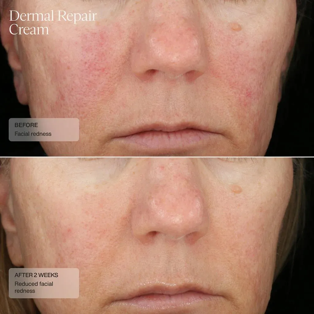 Sente Dermal Repair Cream